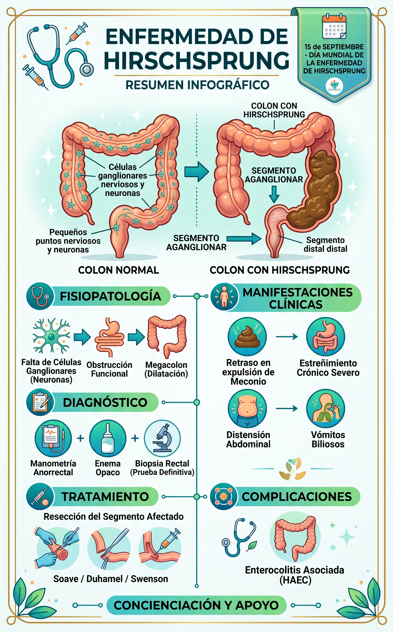 Imagen resumen de la enfermedad de Hirschprung en su día muncial - Generada con Gemini IA