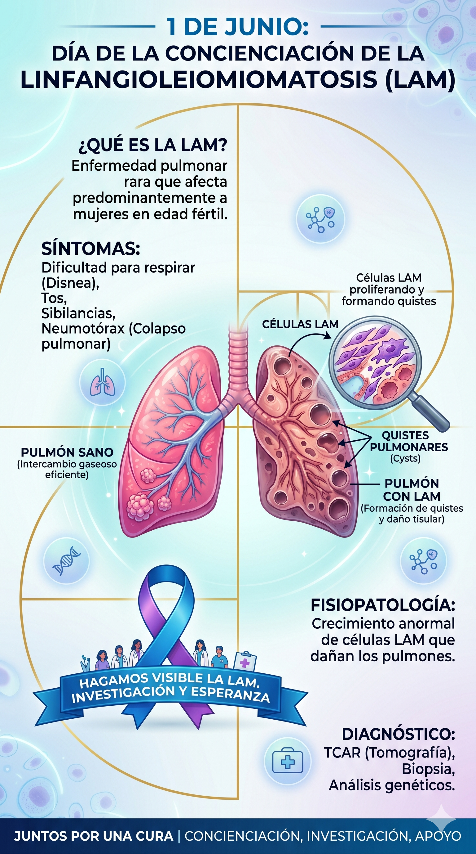 Imagen resumen sobre la Linfangioleiomiomatosis en su día de concienciación - generada con Gemini IA