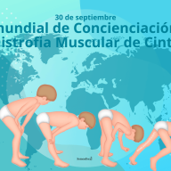 30 de Septiembre:  Día Mundial de Concienciación con la Distrofia Muscular de Cintura