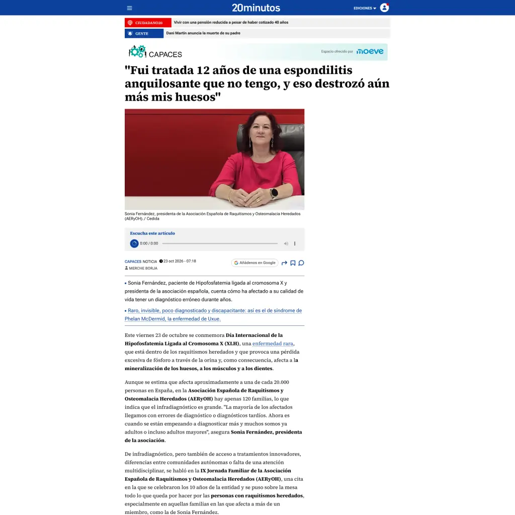 "Fui tratada 12 años de una espondilitis anquilosante que no tengo, y eso destrozó aún más mis huesos"