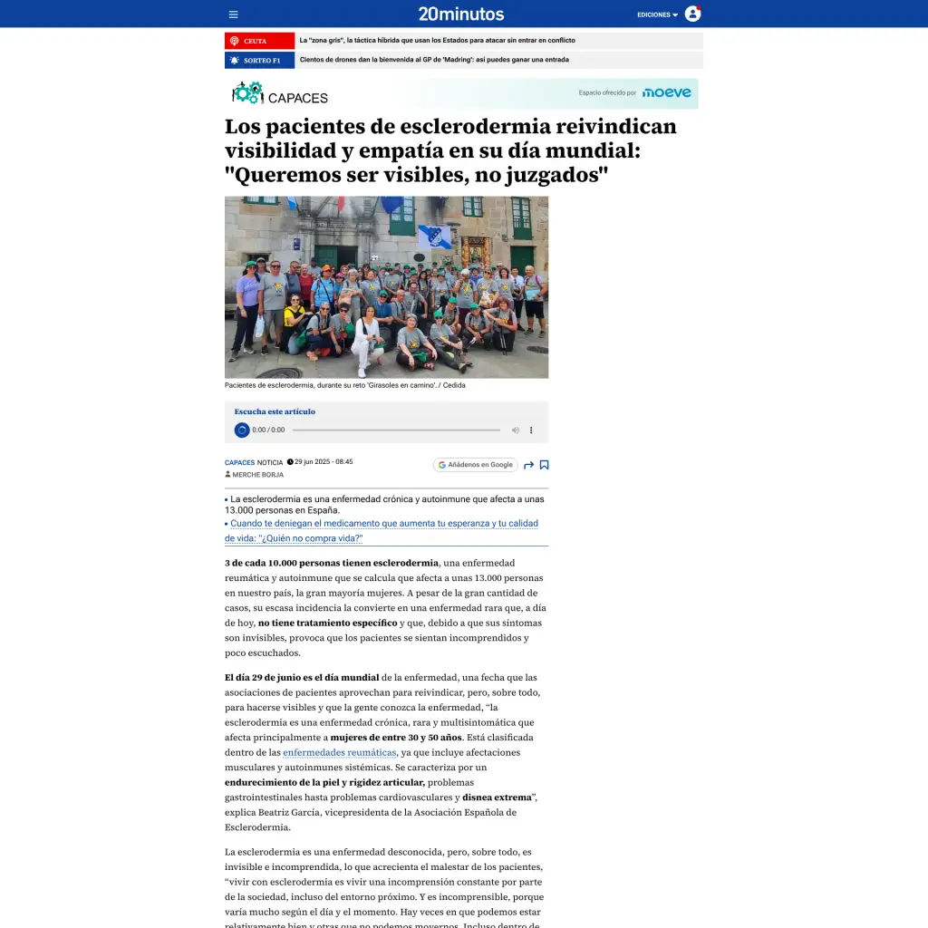 Los pacientes de esclerodermia reivindican visibilidad y empatía en su día mundial: "Queremos ser visibles, no juzgados"
