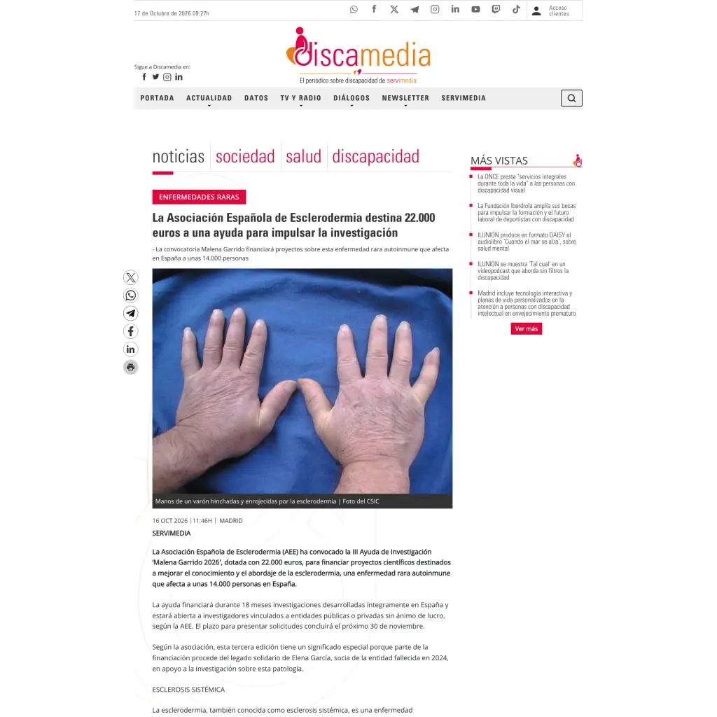La Asociación Española de Esclerodermia destina 22.000 euros a una ayuda para impulsar la investigación