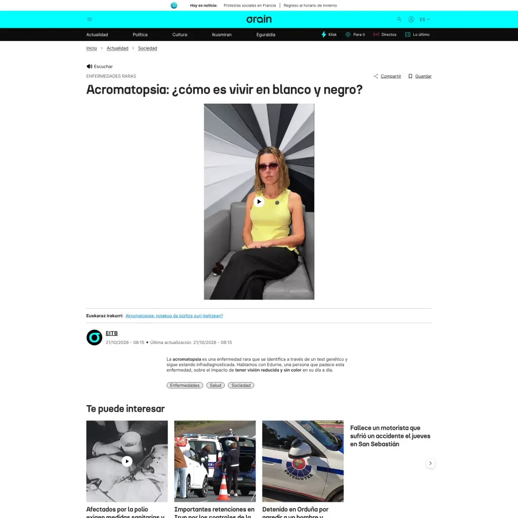 Acromatopsia: ¿cómo es vivir en blanco y negro?